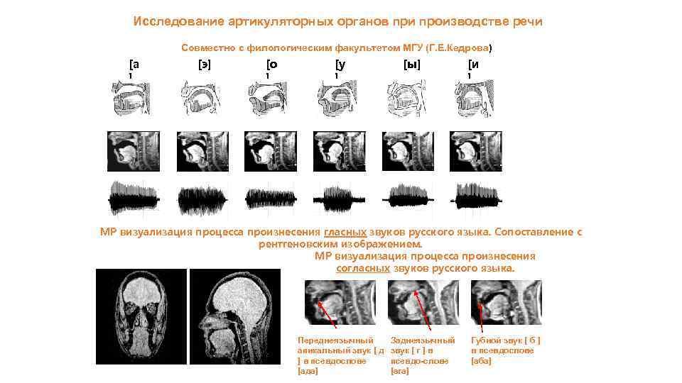 Исследование артикуляторных органов при производстве речи Совместно с филологическим факультетом МГУ (Г. Е. Кедрова)
