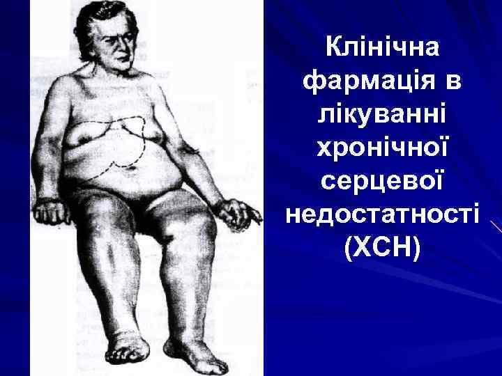 Клінічна фармація в лікуванні хронічної серцевої недостатності (ХСН) 
