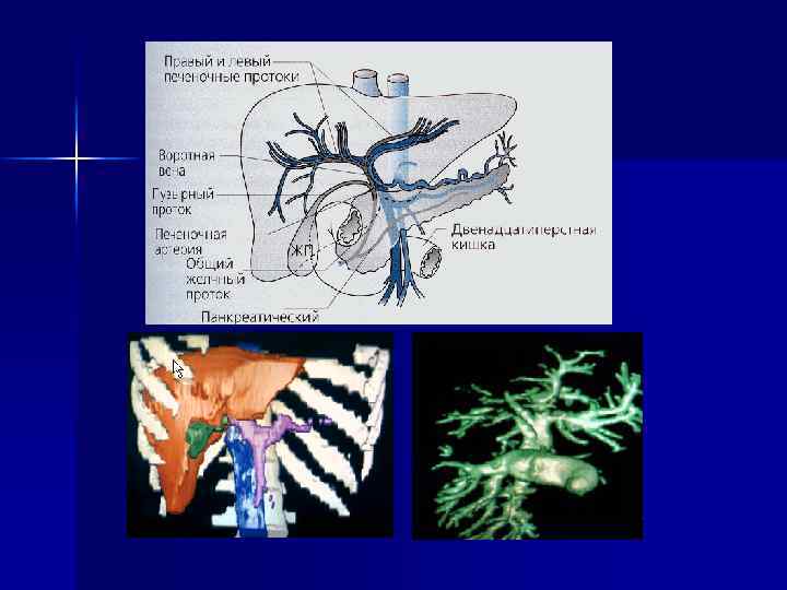 Лучевая диагностика печени и желчевыводящих путей презентация