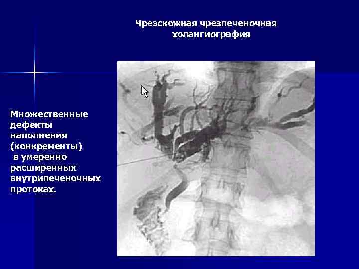 Лучевая диагностика желчевыводящих путей презентация