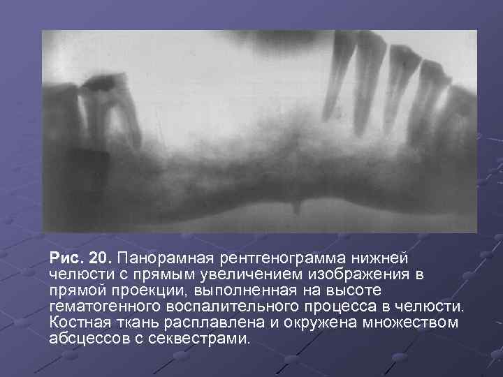 Панорамная рентгенография нижних конечностей