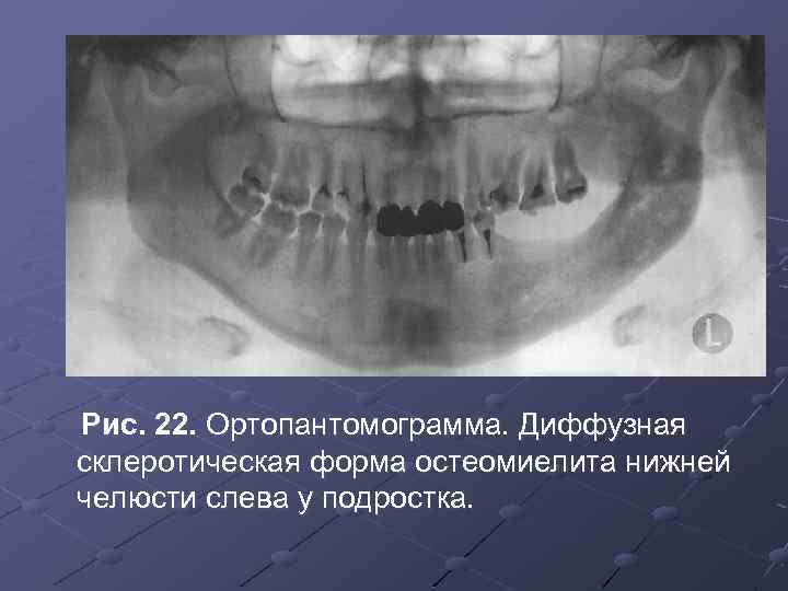 Схема описания ортопантомограммы