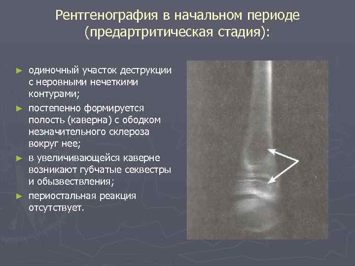 Образец описания рентгенограммы перелома