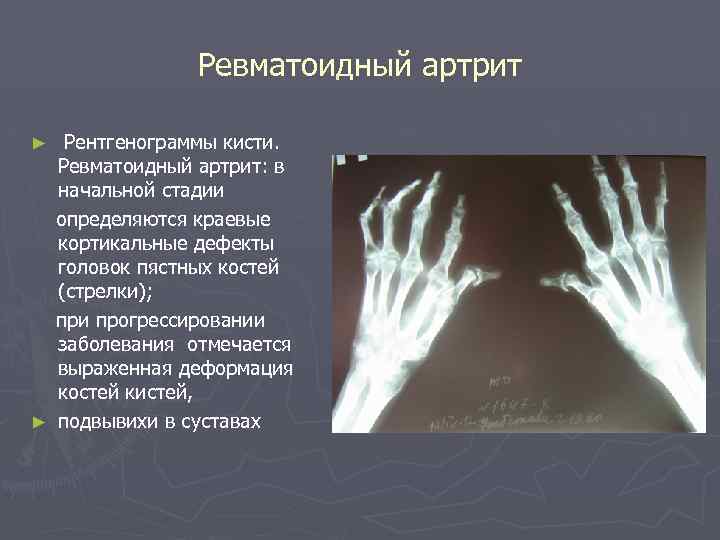 Схема описания рентгенограммы костей