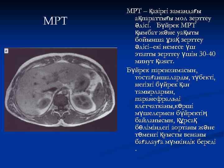 МРТ – қазіргі замандағы ақпараттығы мол зерттеу әдісі. Бүйрек МРТ қымбат және уақыты бойынша