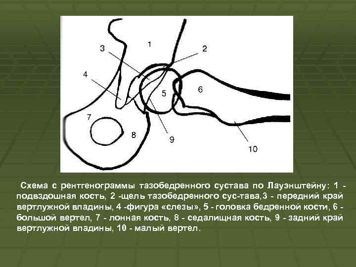 На рисунках представлены рентгенограммы суставов человека какой цифрой отмечена рентгенограмма