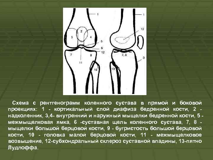 Изображение коленного сустава рентгеновское