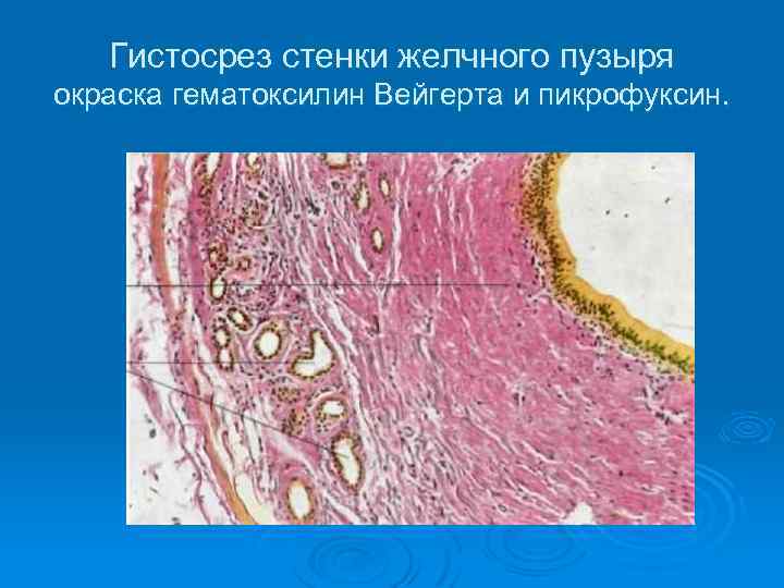 Гистосрез стенки желчного пузыря окраска гематоксилин Вейгерта и пикрофуксин. 