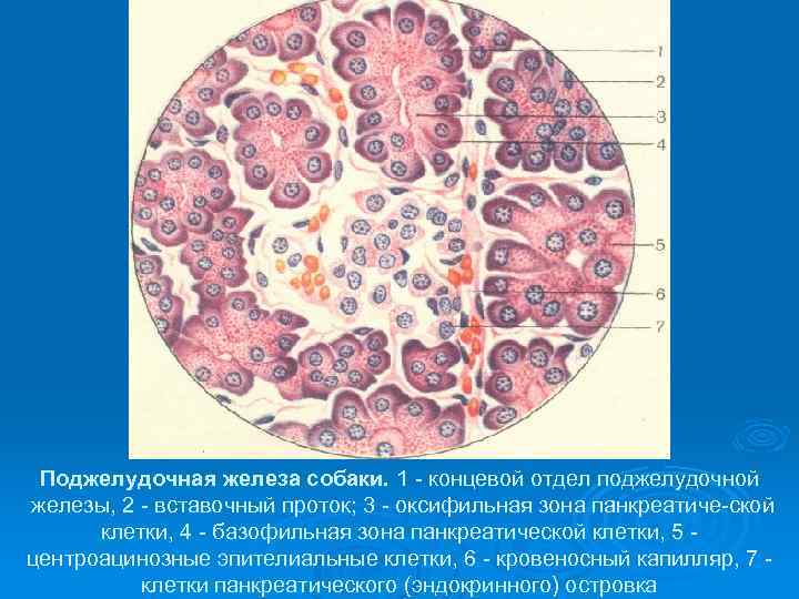 Поджелудочная железа свиньи. Ацинарноклеточная карцинома поджелудочной железы гистология. Ацинарные клетки поджелудочной железы гистология. Поджелудочная железа собаки. Центроацинозные клетки поджелудочной.