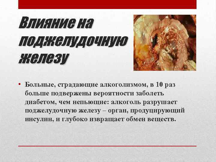Влияние на поджелудочную железу • Больные, страдающие алкоголизмом, в 10 раз больше подвержены вероятности