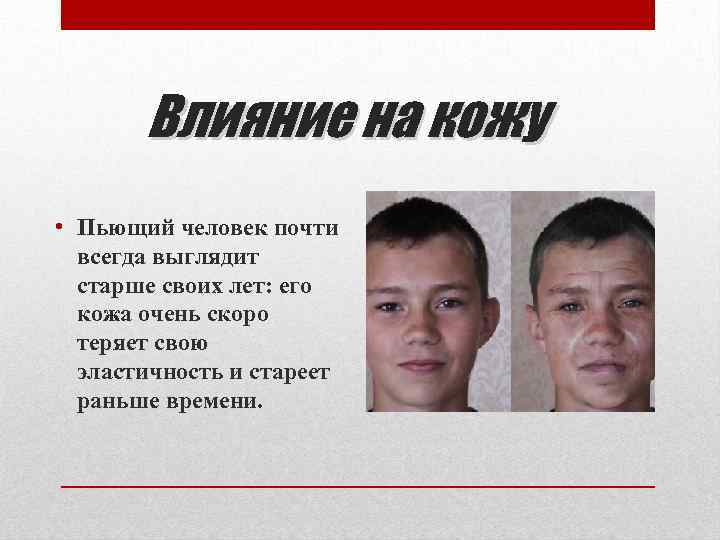 Влияние на кожу • Пьющий человек почти всегда выглядит старше своих лет: его кожа