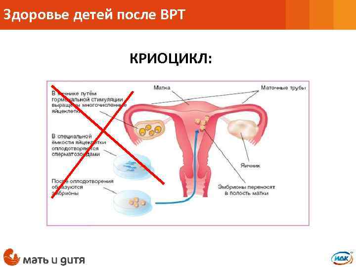 Здоровье детей после ВРТ КРИОЦИКЛ: 