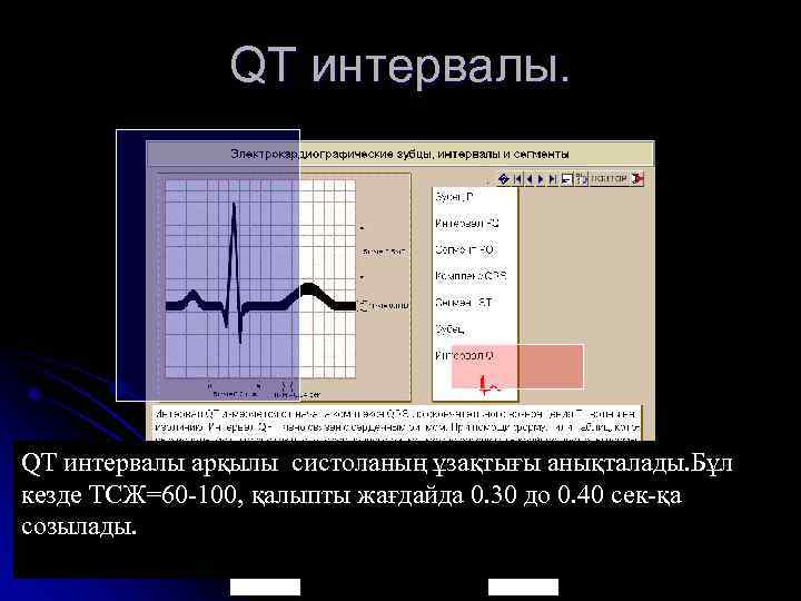 QT интервалы. QT интервалы арқылы систоланың ұзақтығы анықталады. Бұл кезде ТСЖ=60 -100, қалыпты жағдайда