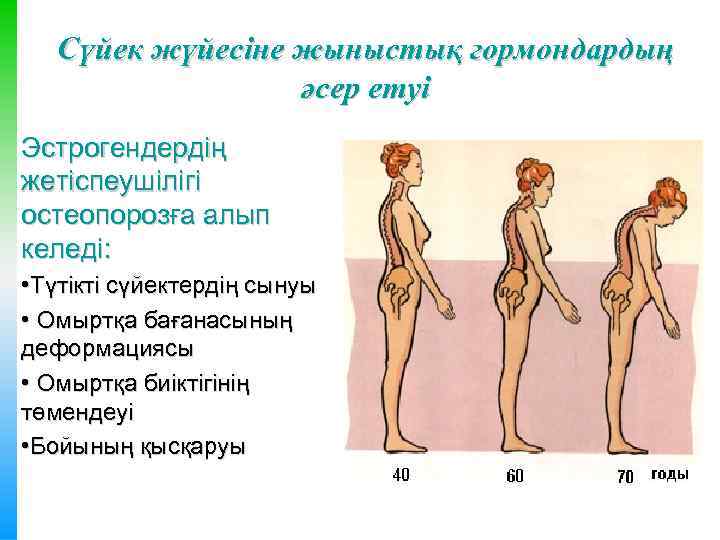 Сүйек жүйесіне жыныстық гормондардың әсер етуі Эстрогендердің жетіспеушілігі остеопорозға алып келеді: • Түтікті сүйектердің
