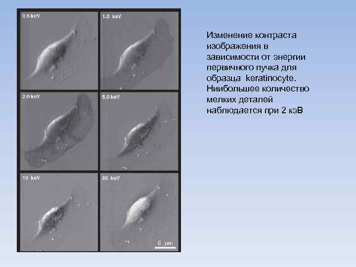 Изменение контраста изображения в зависимости от энергии первичного пучка для образца keratinocyte. Ниибольшее количество