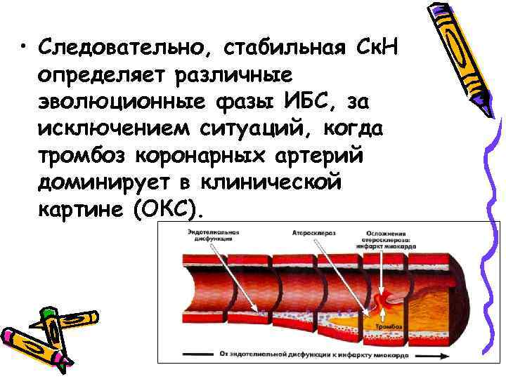  • Следовательно, стабильная Ск. Н определяет различные эволюционные фазы ИБС, за исключением ситуаций,