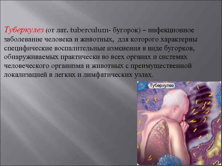 Туберкулез (от лат. tuberculum- бугорок) – инфекционное заболевание человека и животных, для которого характерны