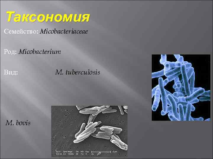 Таксономия Семейство: Мicobacteriaceae Род: Мicobacterium Вид: M. bovis M. tuberculosis 