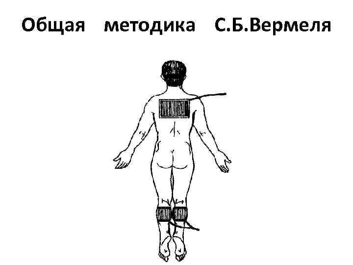 Общая методика С. Б. Вермеля 