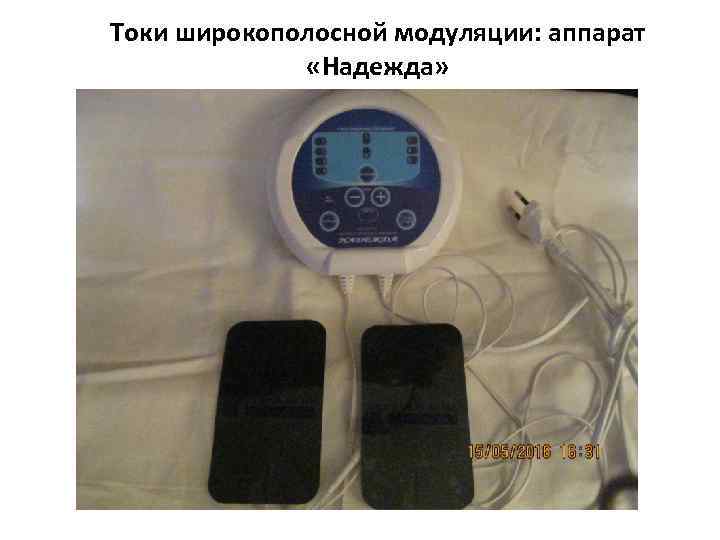 Токи широкополосной модуляции: аппарат «Надежда» 