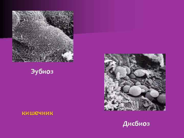 Эубиоз кишечник Дисбиоз 