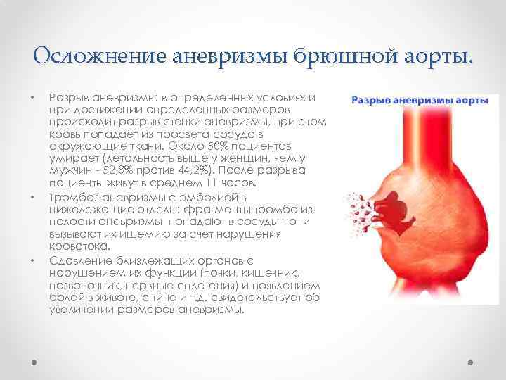 Осложнение аневризмы брюшной аорты. • • • Разрыв аневризмы: в определенных условиях и при