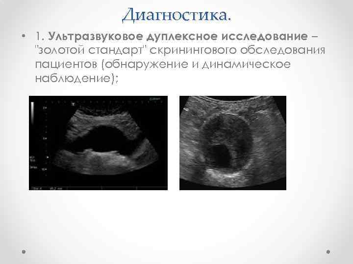 Диагностика. • 1. Ультразвуковое дуплексное исследование – "золотой стандарт" скринингового обследования пациентов (обнаружение и