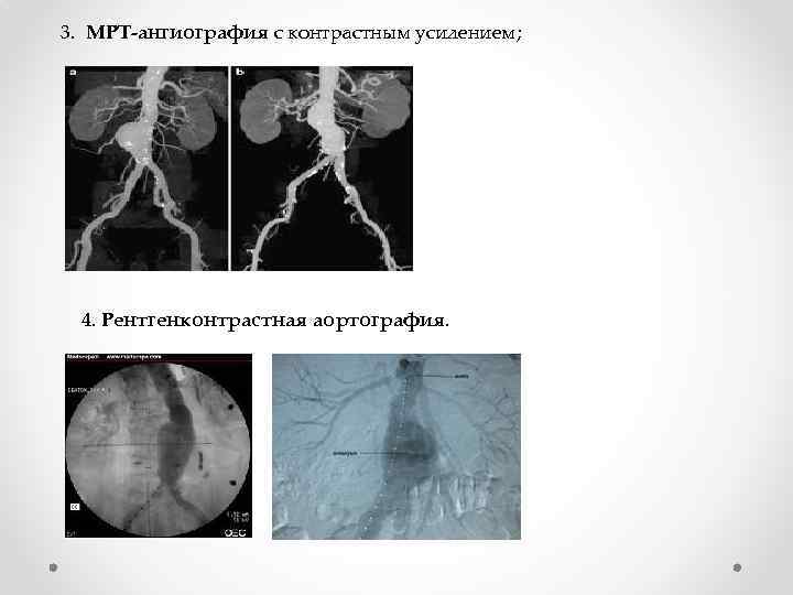 3. МРТ-ангиография с контрастным усилением; 4. Рентгенконтрастная аортография. 