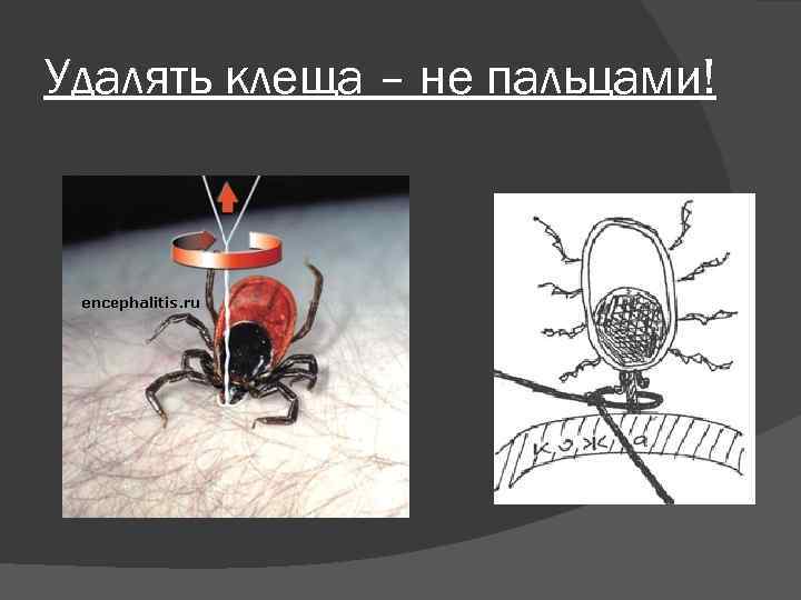 Удалять клеща – не пальцами! 