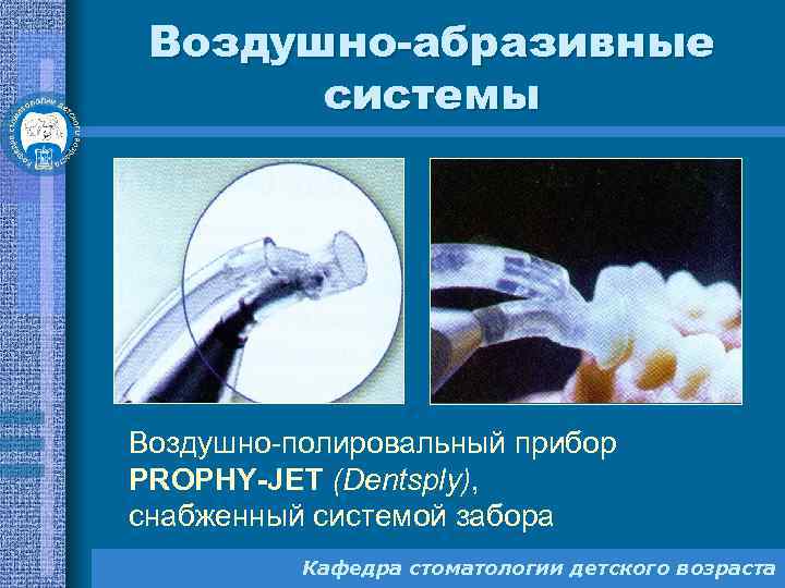 Воздушно-абразивные системы Воздушно-полировальный прибор PROPHY-JET (Dentsply), снабженный системой забора Кафедра стоматологии детского возраста 