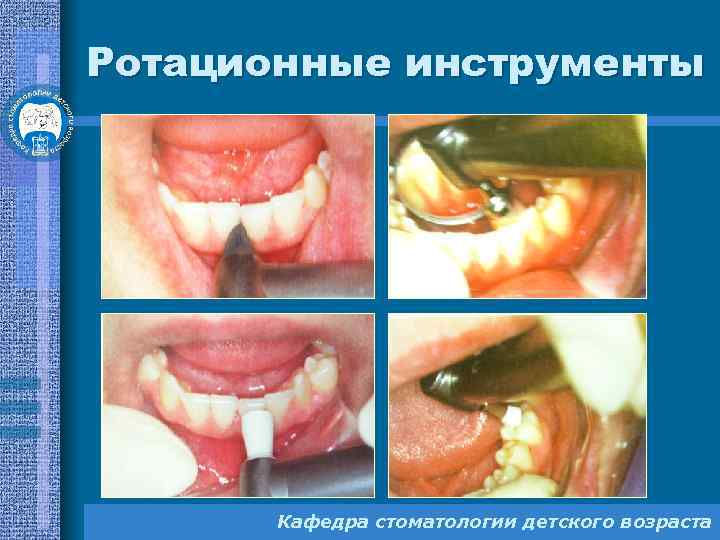 Ротационные инструменты Кафедра стоматологии детского возраста 