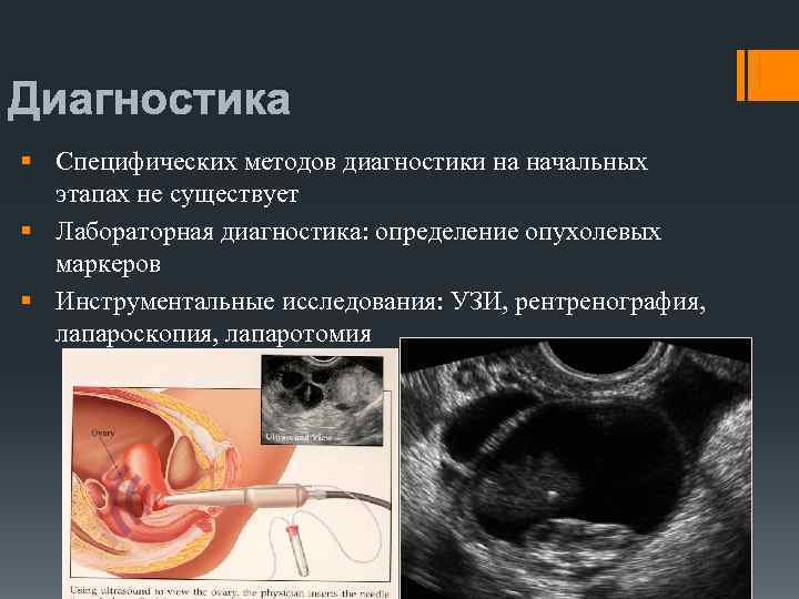 Киста гартнерова хода фото