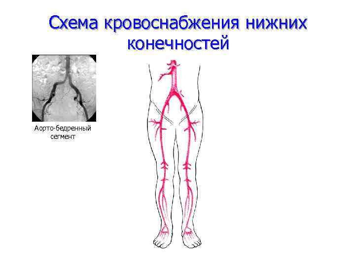 Схема кровоснабжения нижних конечностей Аорто-бедренный сегмент 
