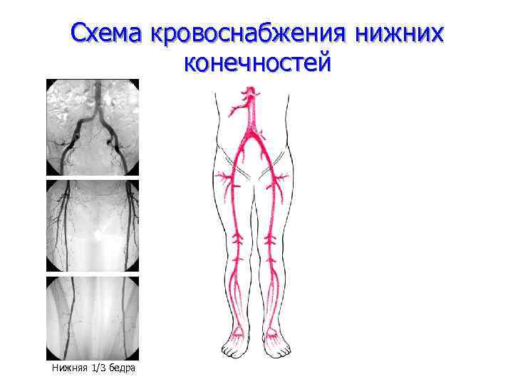 Схема кровоснабжения нижних конечностей Нижняя 1/3 бедра 