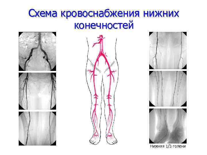 Схема кровоснабжения нижних конечностей Нижняя 1/3 голени 
