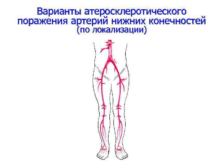 Артерии нижних конечностей фото