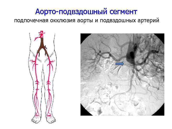 Схема кровоснабжения человека