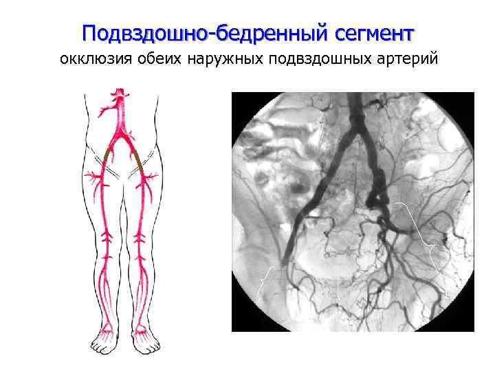 Схема кровоснабжения человека