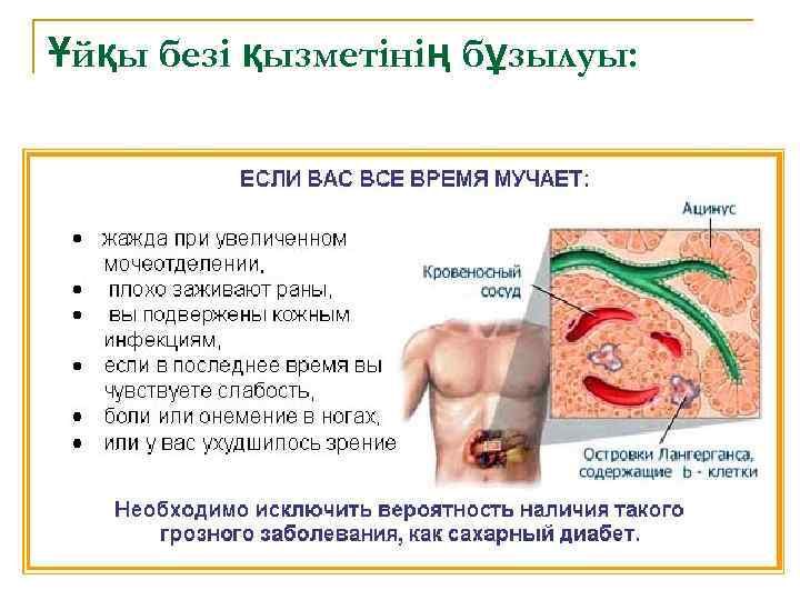 Ұйқы безі қызметінің бұзылуы: 