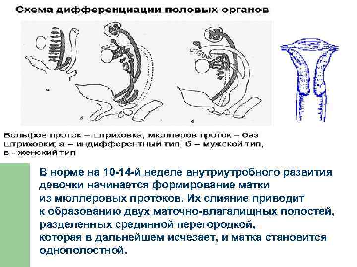 В норме на 10 -14 -й неделе внутриутробного развития девочки начинается формирование матки из