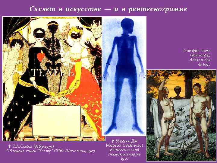 Скелет в искусстве — и в рентгенограмме Ганс фон Тома (1839 -1924) Адам и