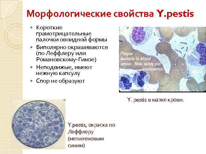 Морфологические свойства Y. pestis Короткие грамотрицательные палочки овоидной формы Биполярно окрашиваются (по Леффлеру или