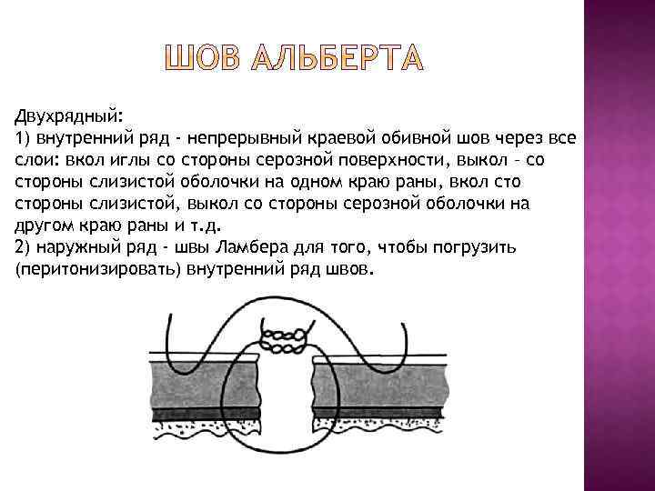 Двухрядный: 1) внутренний ряд - непрерывный краевой обивной шов через все слои: вкол иглы