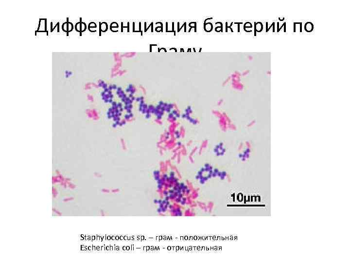 Дифференциация бактерий по Граму Staphylococcus sp. – грам - положительная Escherichia coli – грам