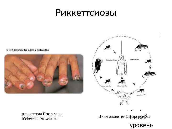 Риккеттсиозы Для правки структуры щелкните мышью Второй уровень структуры Третий уровень структуры Четвёртый уровень