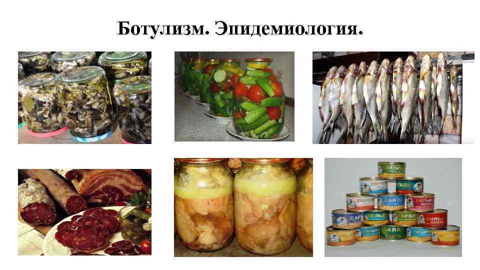 Ботулизм. Эпидемиология. 