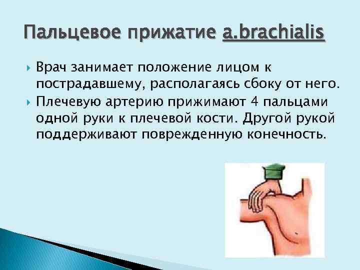 Пальцевое прижатие a. brachialis Врач занимает положение лицом к пострадавшему, располагаясь сбоку от него.