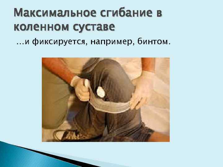 Максимальное сгибание в коленном суставе …и фиксируется, например, бинтом. 