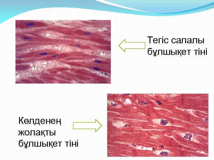 Тегіс салалы бұлшықет тіні Көлденең жолақты бұлшықет тіні 