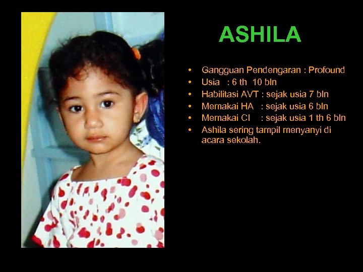 ASHILA • • • Gangguan Pendengaran : Profound Usia : 6 th 10 bln